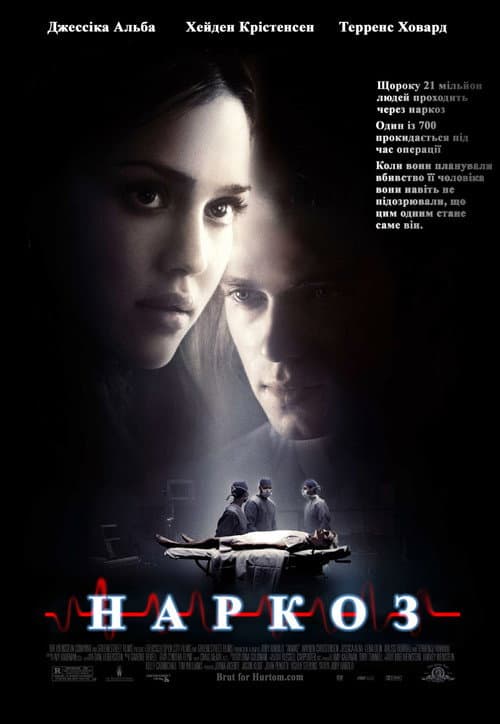 Наркоз